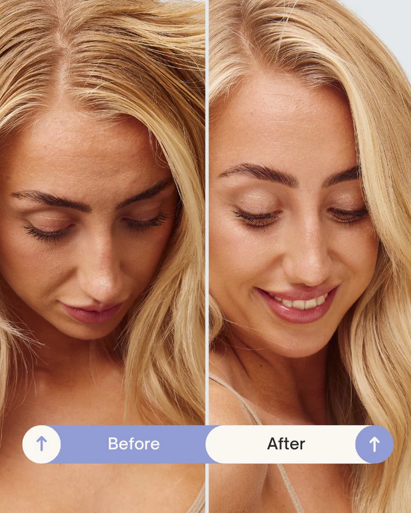 Refresh Powder™ Dry Shampoo - Image 7