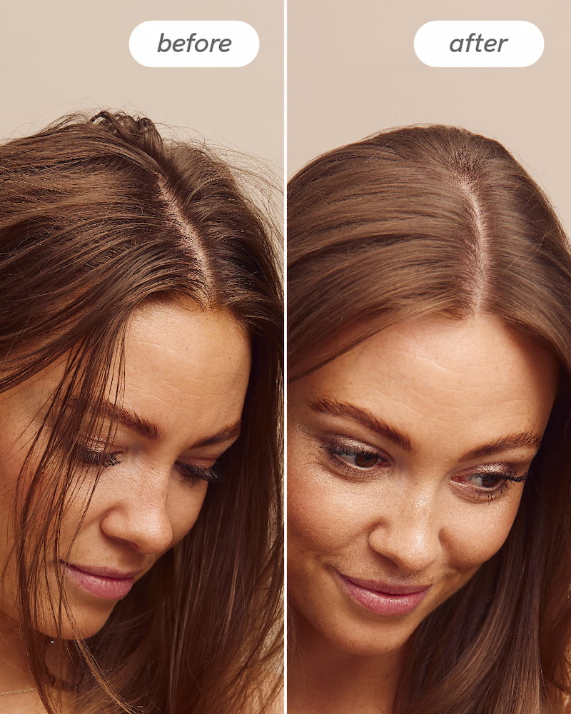 Scalp Delight™ Bundle - Image 5